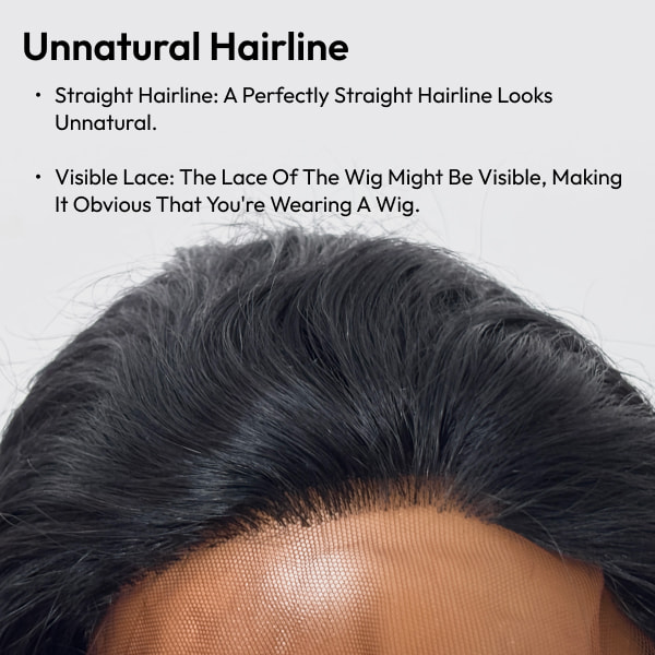 common reasons unnatural hairline